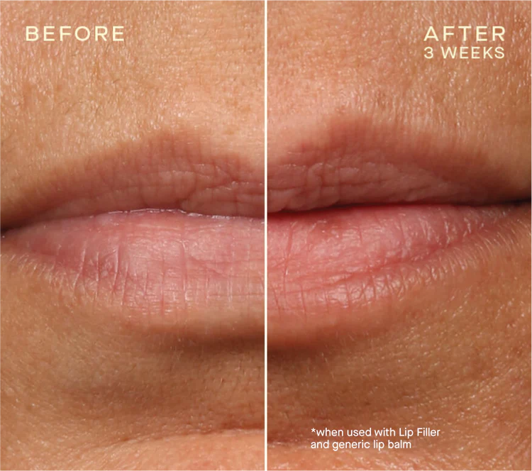 The Lip Plumping and Enhancing Regimen