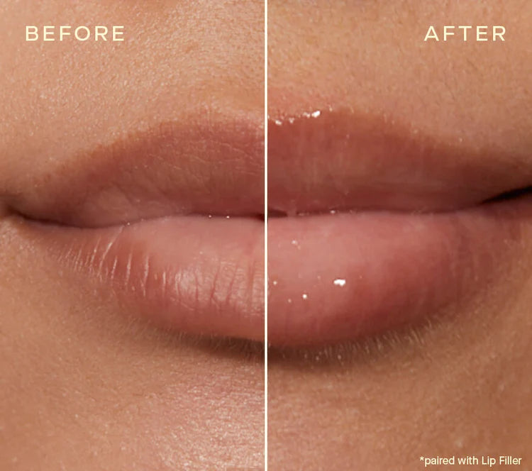 The Lip Plumping and Enhancing Regimen