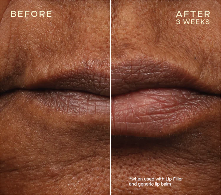 The Lip Plumping and Enhancing Regimen