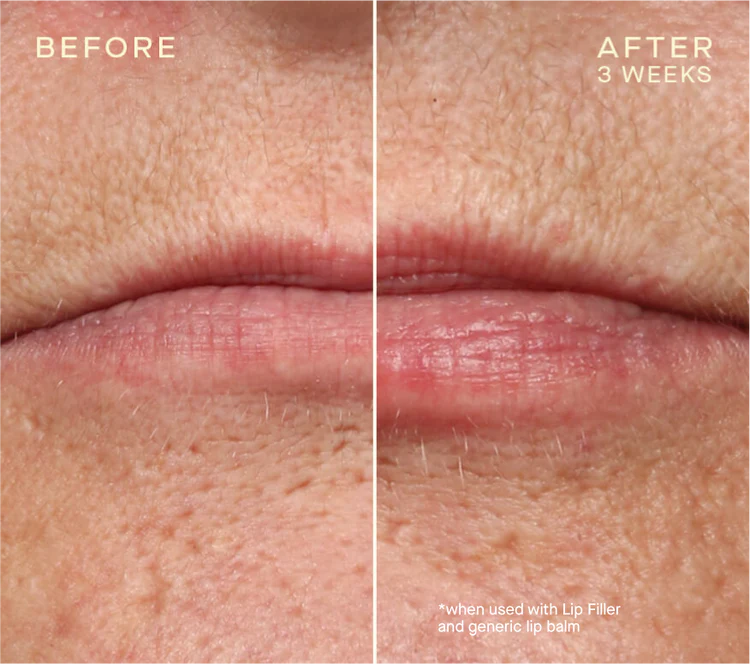 The Lip Plumping and Enhancing Regimen