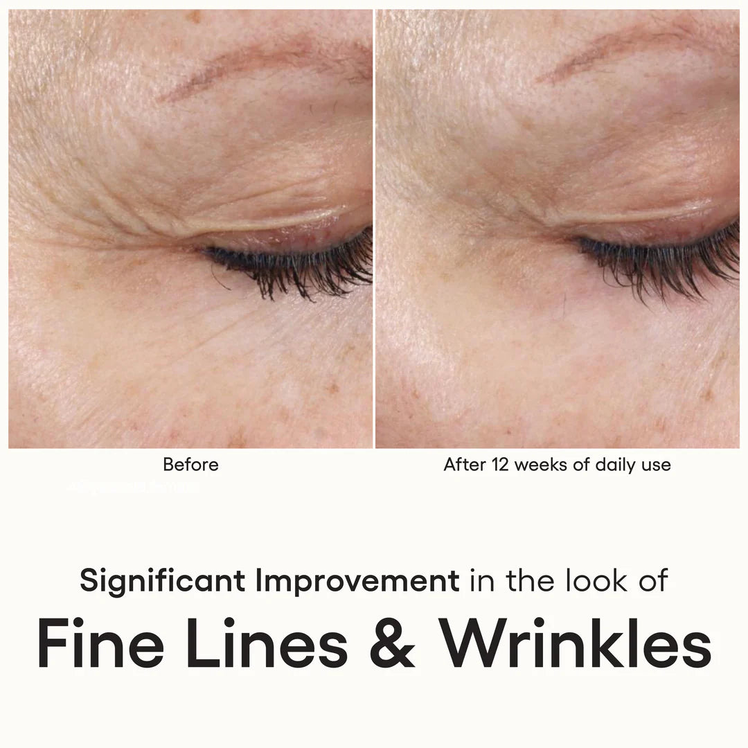 (plated) Intense Serum PREORDER