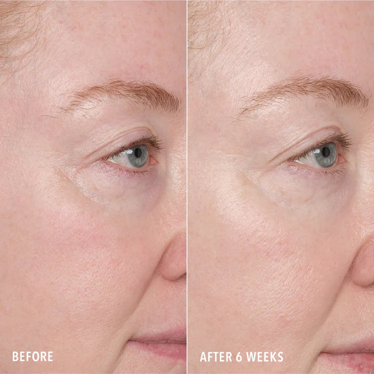 Resurface & Repair Peptide Pads