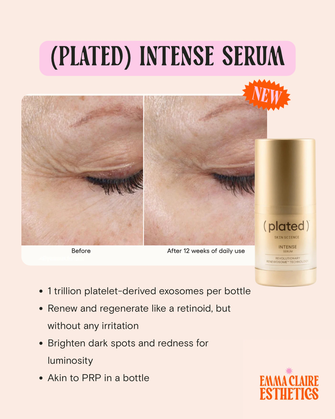 (plated) Intense Serum PREORDER