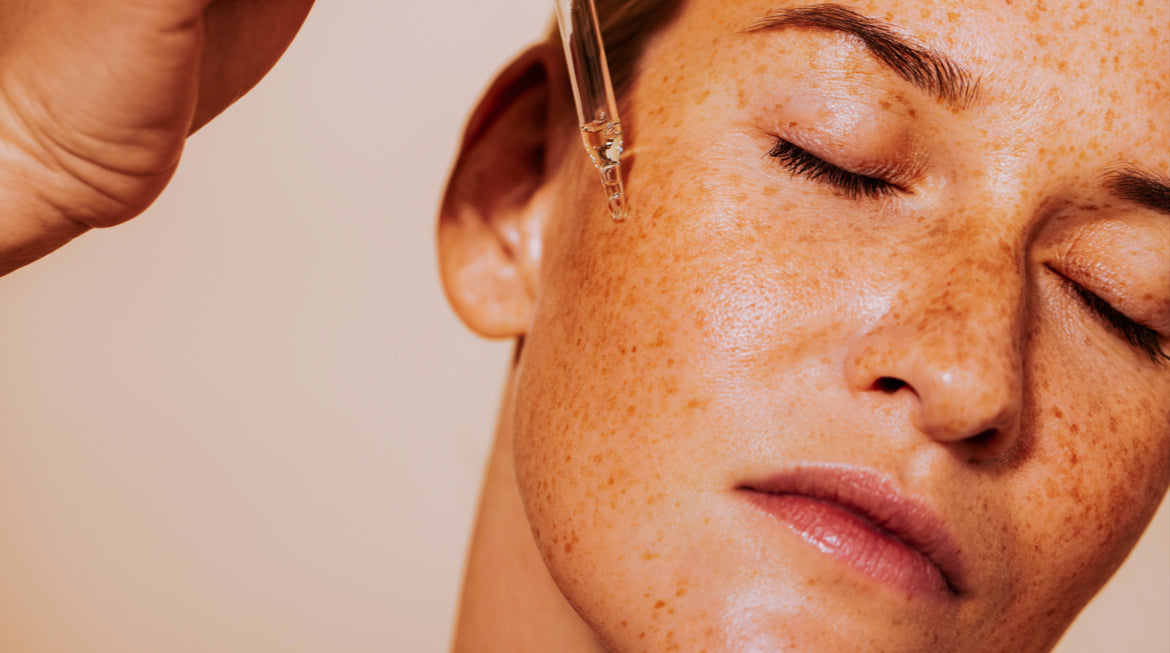 skincare acne facial temecula california