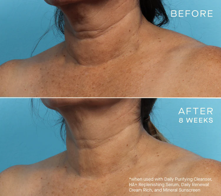 HA+ Replenishing Serum