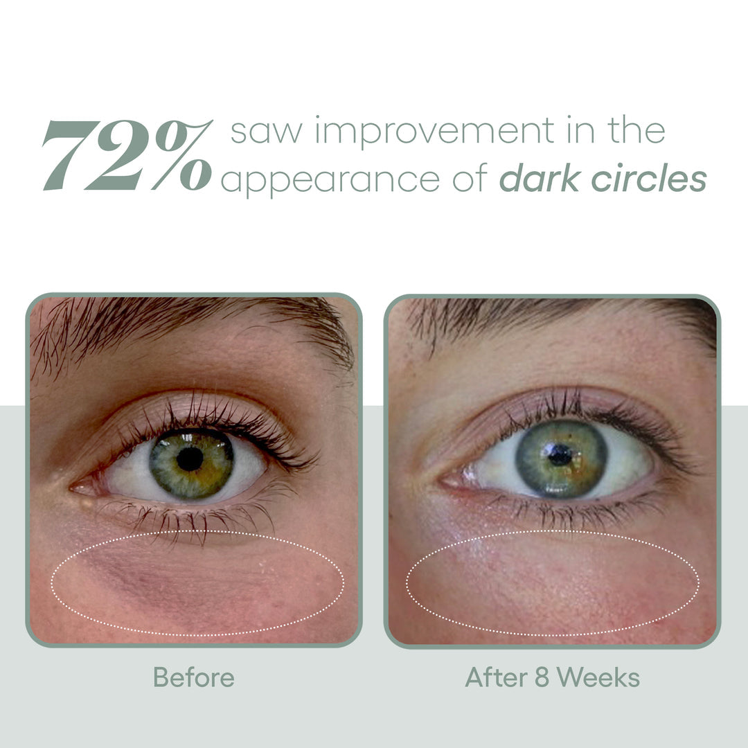 (plated) Eye Serum