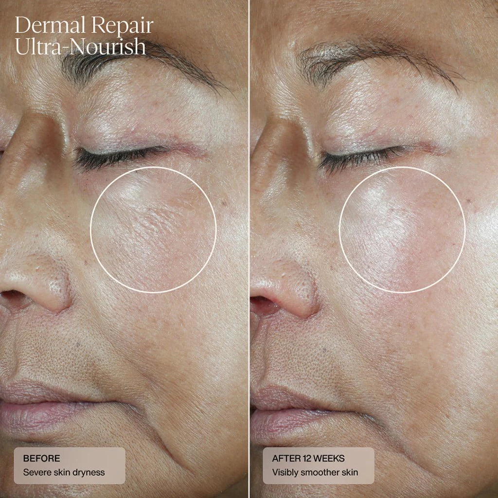 Dermal Repair Cream Ultra-Nourish