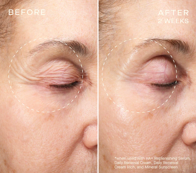 HA+ Replenishing Serum