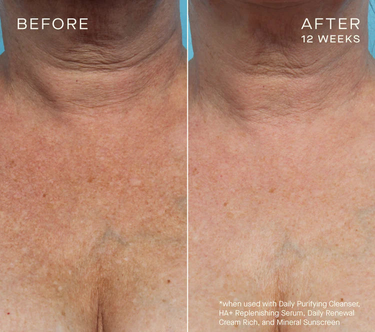 HA+ Replenishing Serum