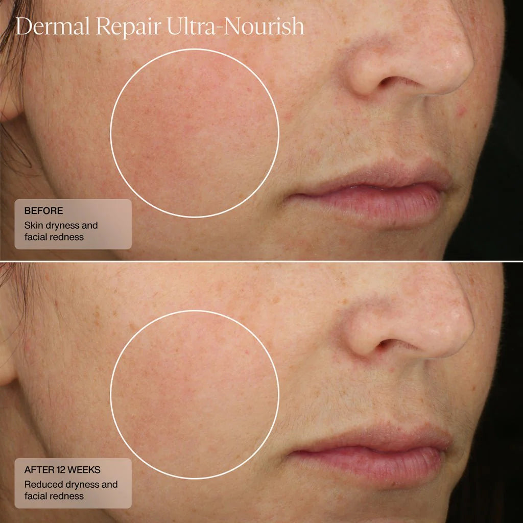 Dermal Repair Cream Ultra-Nourish